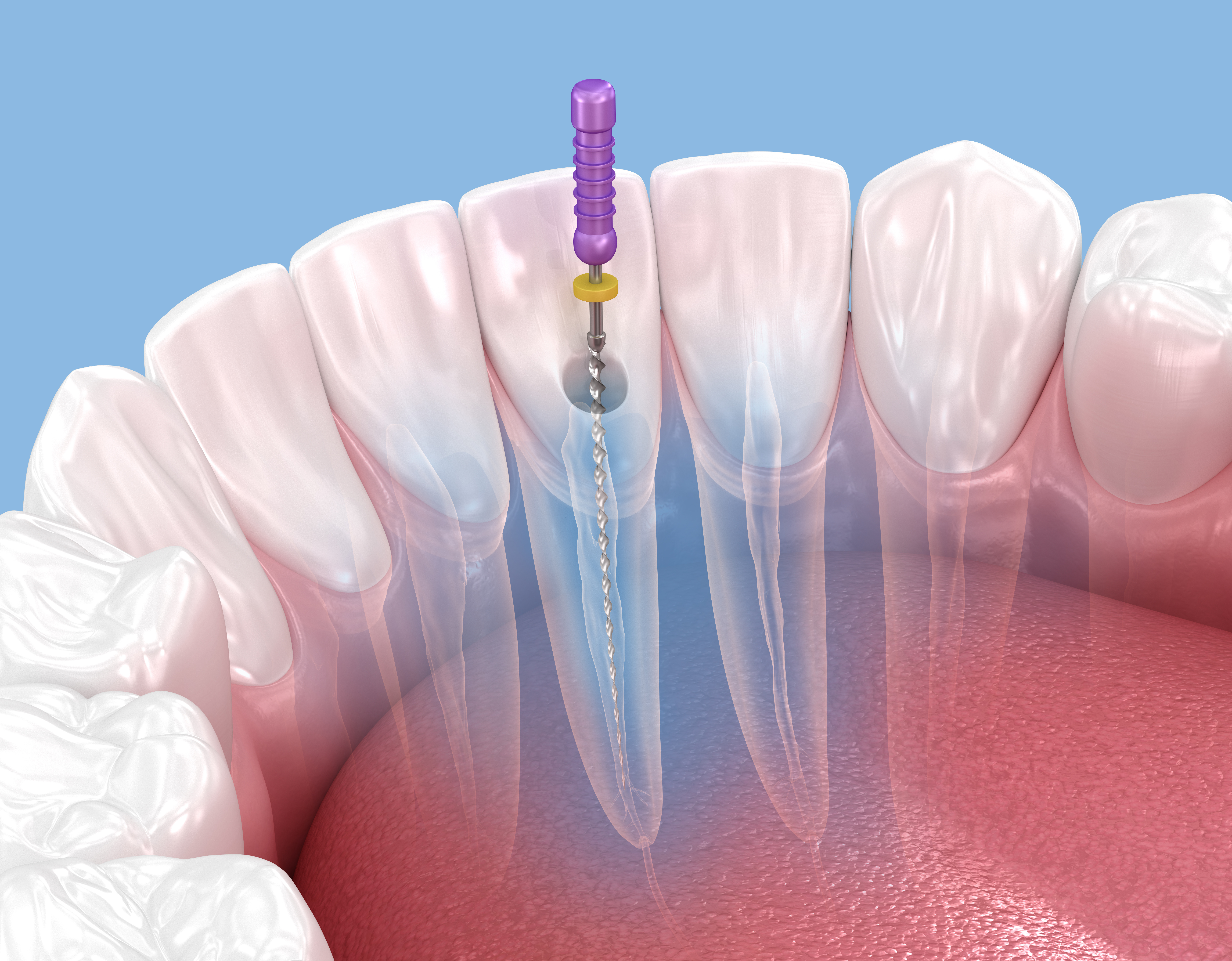 Leczenie protetyczne